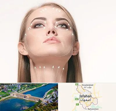 لیفت صورت با نخ در اصفهان
