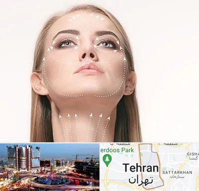 لیفت صورت با نخ در صادقیه 