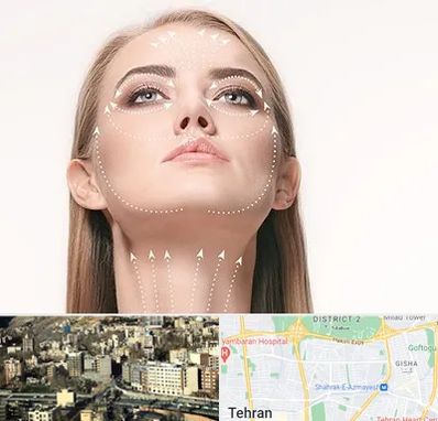 لیفت صورت با نخ در مرزداران 