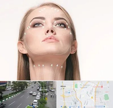 لیفت صورت با نخ در ستارخان 