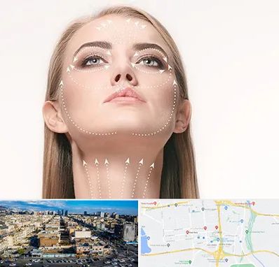 لیفت صورت با نخ در شهرک راه آهن