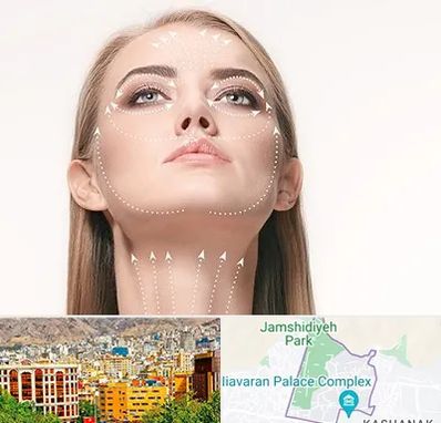 لیفت صورت با نخ در نیاوران 