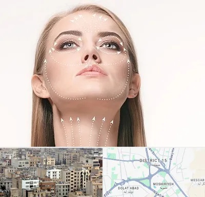 لیفت صورت با نخ در جنوب شرق تهران