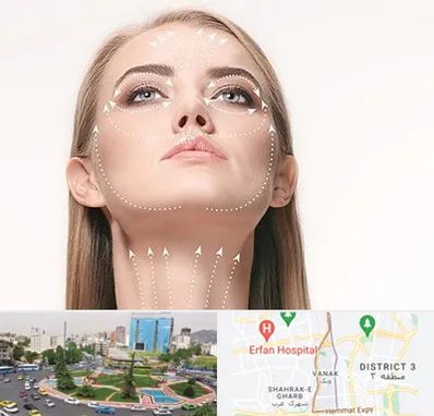 لیفت صورت با نخ در ونک 