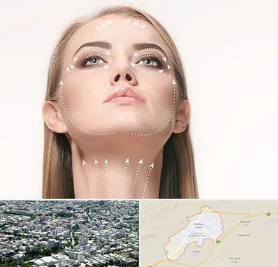 لیفت صورت با نخ در شاهرود