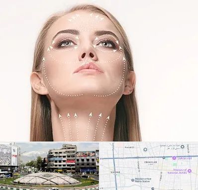 لیفت صورت با نخ در مرکز تهران