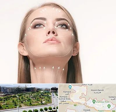 لیفت صورت با نخ در پردیس