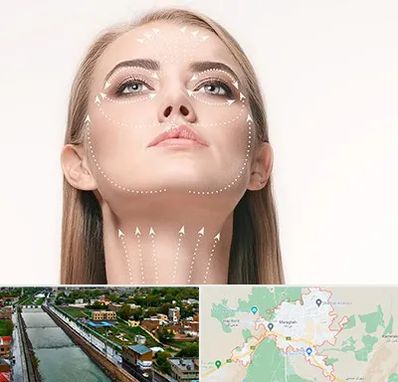 لیفت صورت با نخ در مراغه