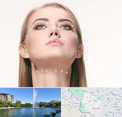 لیفت صورت با نخ در کوهسنگی مشهد