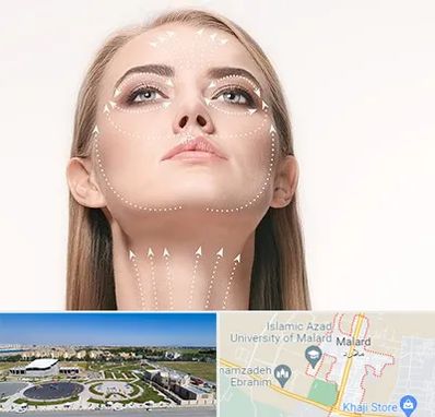 لیفت صورت با نخ در ملارد