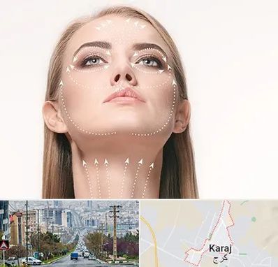 لیفت صورت با نخ در گوهردشت کرج 