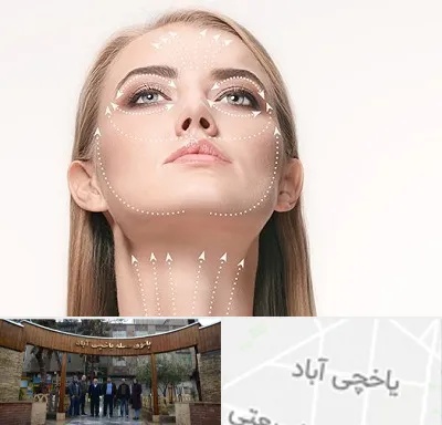 لیفت صورت با نخ در یاخچی آباد