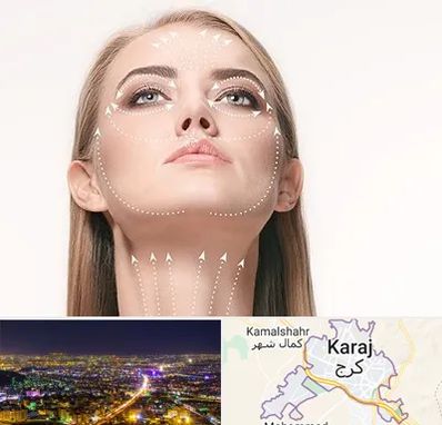 لیفت صورت با نخ در کرج