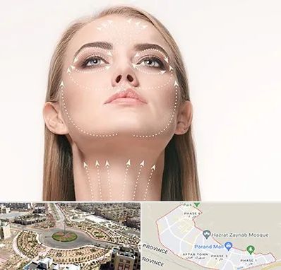 لیفت صورت با نخ در پرند