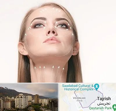 لیفت صورت با نخ در زعفرانیه 