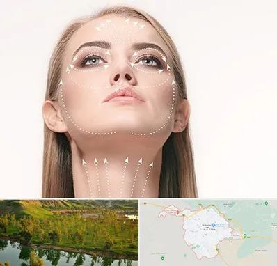 لیفت صورت با نخ در بهبهان