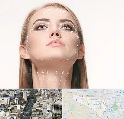 لیفت صورت با نخ در منطقه 18 تهران 