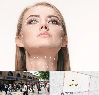 لیفت صورت با نخ در بازار تهران