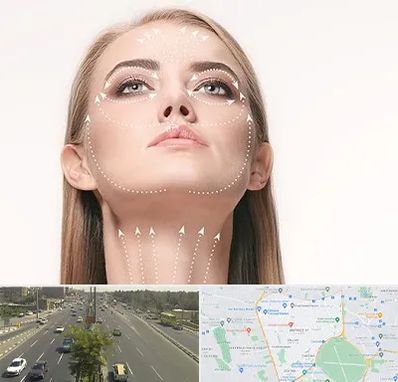 لیفت صورت با نخ در منطقه 17 تهران 