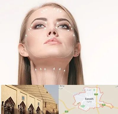 لیفت صورت با نخ در ساوه