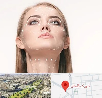 لیفت صورت با نخ در شهرک گلستان