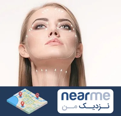 لیفت صورت با نخ در نزدیک من