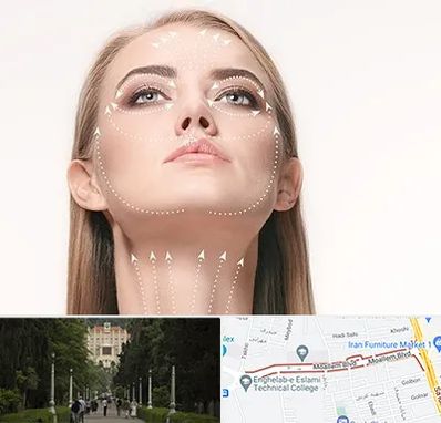 لیفت صورت با نخ در بلوار معلم رشت 