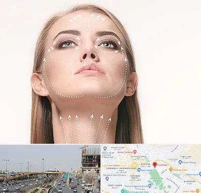 لیفت صورت با نخ در بلوار توس مشهد 