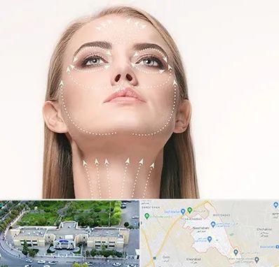 لیفت صورت با نخ در نسیم شهر