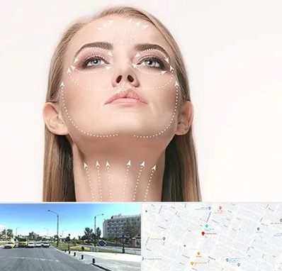 لیفت صورت با نخ در بلوار کلاهدوز مشهد 