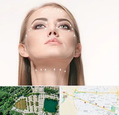 لیفت صورت با نخ در وکیل آباد مشهد 