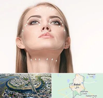 لیفت صورت با نخ در بابل