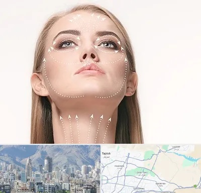 لیفت صورت با نخ در شمال شرق تهران