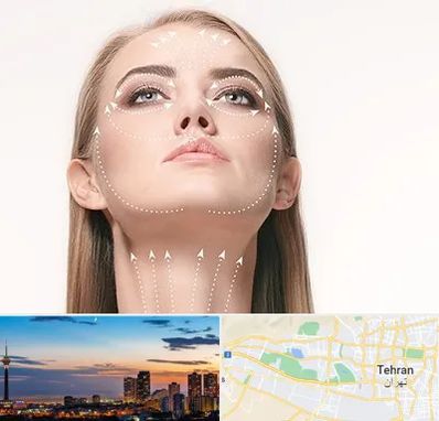 لیفت صورت با نخ در غرب تهران 