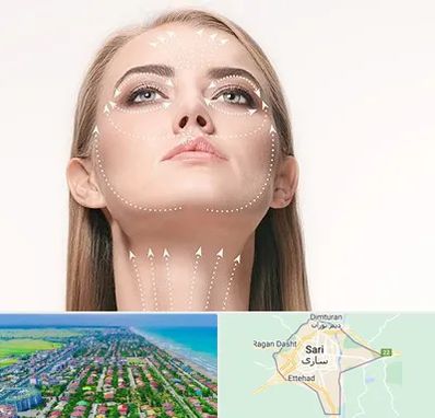 لیفت صورت با نخ در ساری