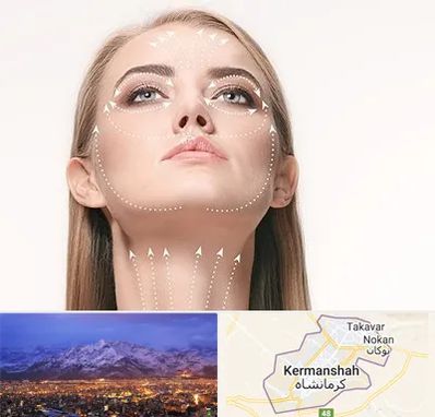 لیفت صورت با نخ در کرمانشاه