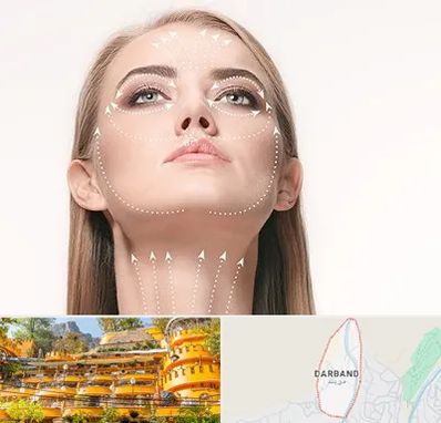 لیفت صورت با نخ در دربند