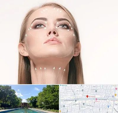 لیفت صورت با نخ در هشت بهشت اصفهان