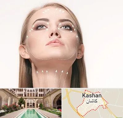 لیفت صورت با نخ در کاشان