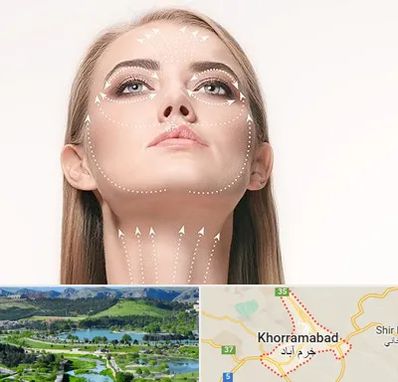 لیفت صورت با نخ در خرم آباد