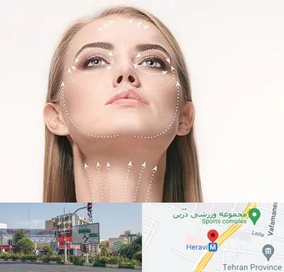 لیفت صورت با نخ در هروی 