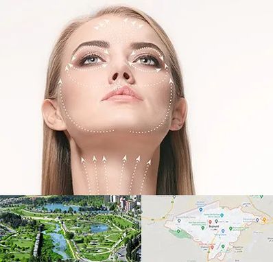 لیفت صورت با نخ در بجنورد