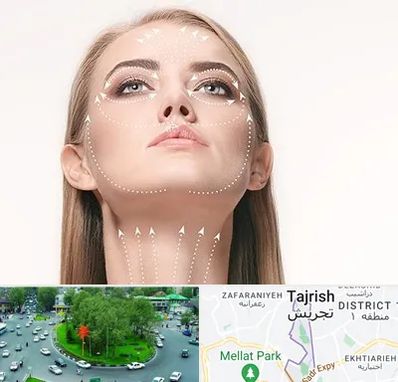 لیفت صورت با نخ در تجریش 