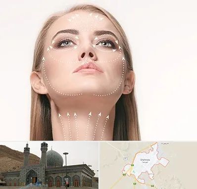 لیفت صورت با نخ در شهرضا