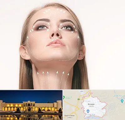 لیفت صورت با نخ در برازجان