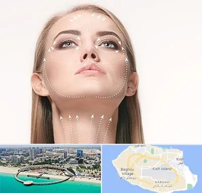 لیفت صورت با نخ در کیش