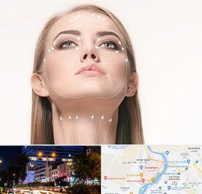 لیفت صورت با نخ در کیانپارس اهواز