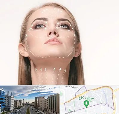 لیفت صورت با نخ در سعادت آباد 