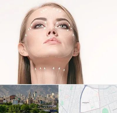 لیفت صورت با نخ در جمشیدیه