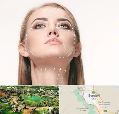 لیفت صورت با نخ در بروجرد